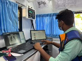 AI for TB Screening