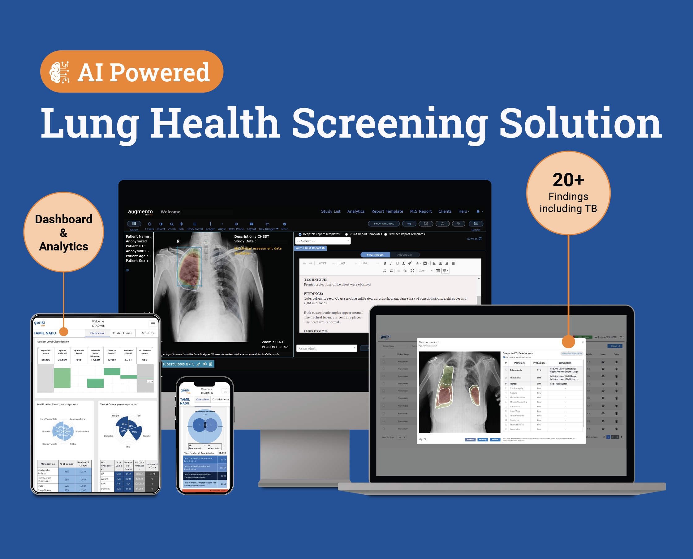 AI for Tuberclosis